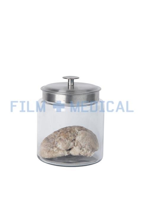 Brain Model In Glass Jar 